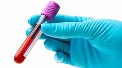 Dichiarazione di paternità: il rifiuto a sottoporsi ai test può ingenerare al giudice il sospetto della paternità.