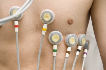 Un uomo con problemi cardiaci viene ricoverato in chirugia perchè non ci sono posti liberi in cardiologia. Ivi giunto muore. Nessuna responsabilità al medico.
