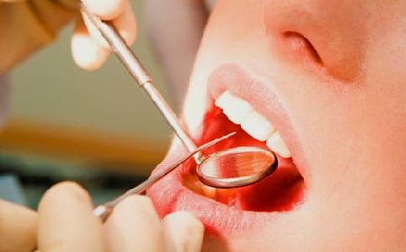 Dentista fornisce adeguata informazione al paziente sui rischi dell'intervento.