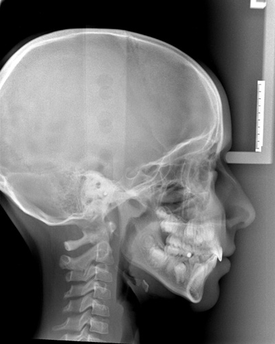 La Guardia di Finanza può sequestrare un hard disk di un odontoiatra con tutti i...