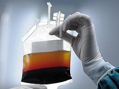 Errore nella trasfusione di sangue.