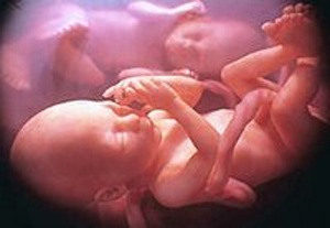L'indennità di maternità nell'ipotesi di parto (o adozione) plurimi va m...